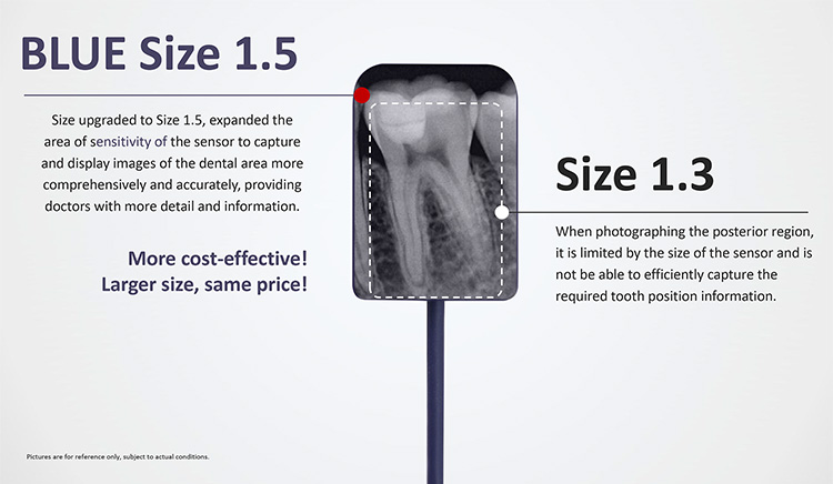 XR44B Digital Intraoral Sensor